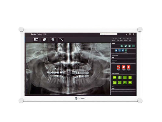 Écran Ag 21,5 pouces FHD 1920 x 1080, 500 nits, 1000:1, 5 ms, 178/178, Dicom M
